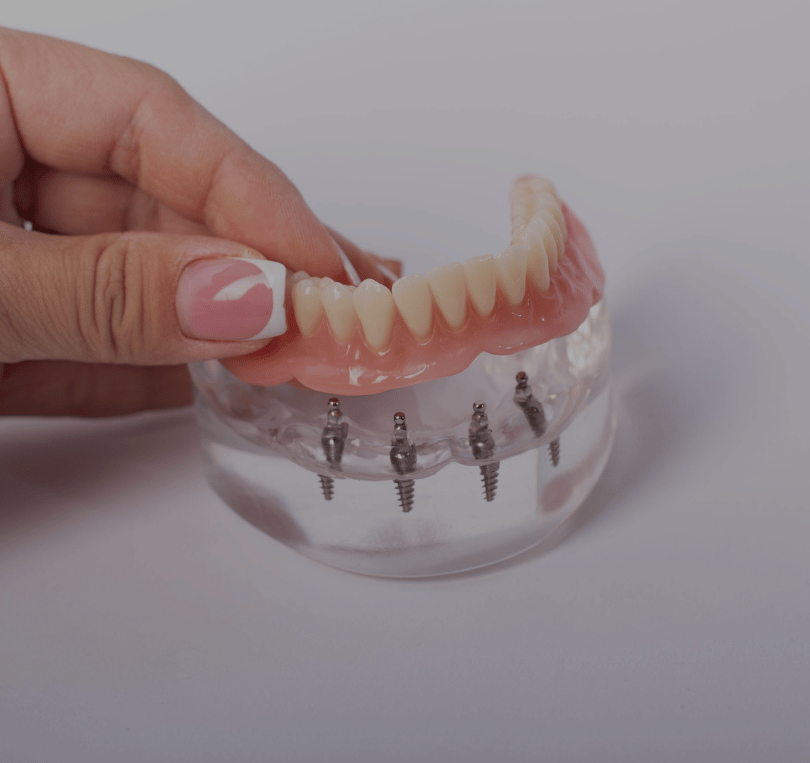 Treatment - KT Dental
