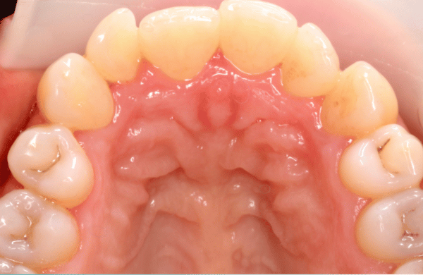 Before - brecknockdental